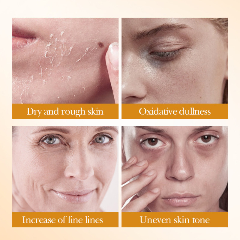 Juego de blanqueamiento crudo  - Luxury Skincare Kit reseña y precio